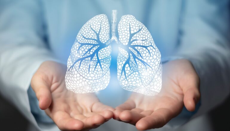 La Inacción en el cáncer de pulmón  genera  aumento  en el número de muerte prematuras